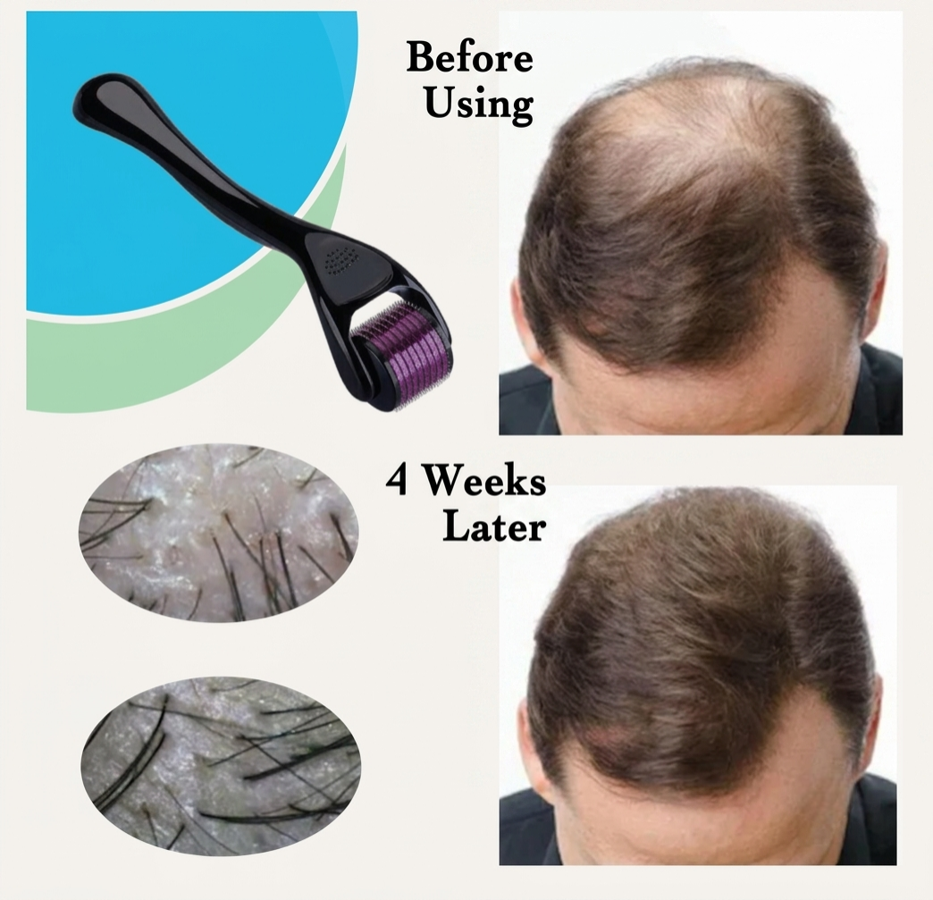 Derma Roller